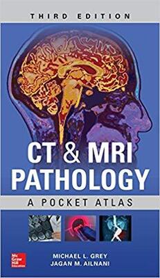 Ct & Mri Pathology: A Pocket Atlas, Third Edition